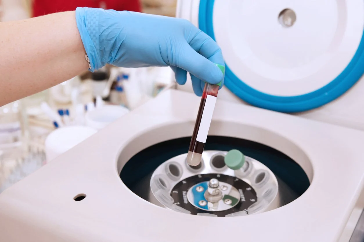 Platelet Rich Plasma Centrifuge