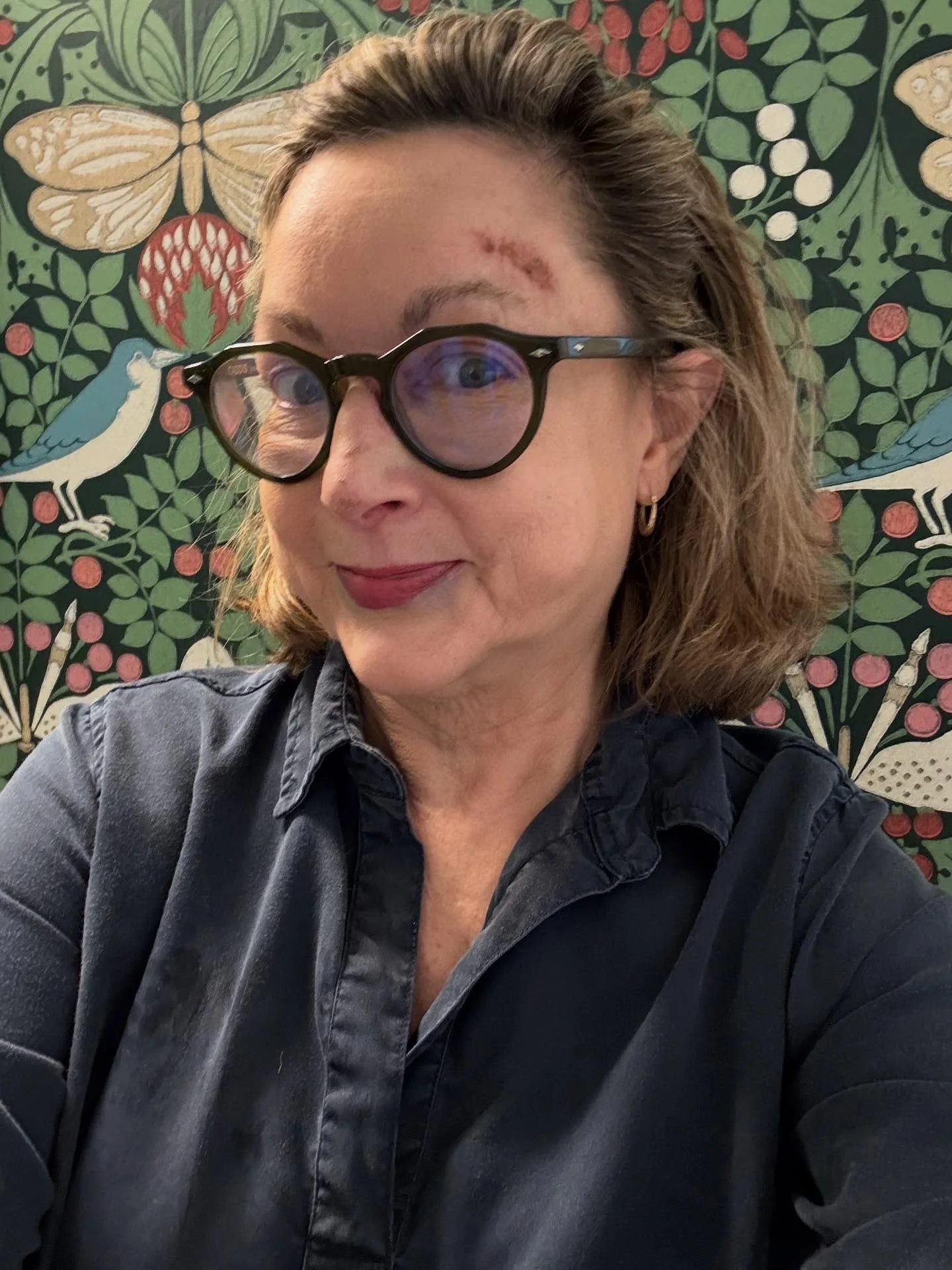 Thanks, everyone who offered ways to help my banged-up face. Y&rsquo;all be careful, there are some mean sidewalks out there, and I still can&rsquo;t believe I had no broken bones or teeth. The winning combo are Aquaphore, Arnica gel, and Dermablend.