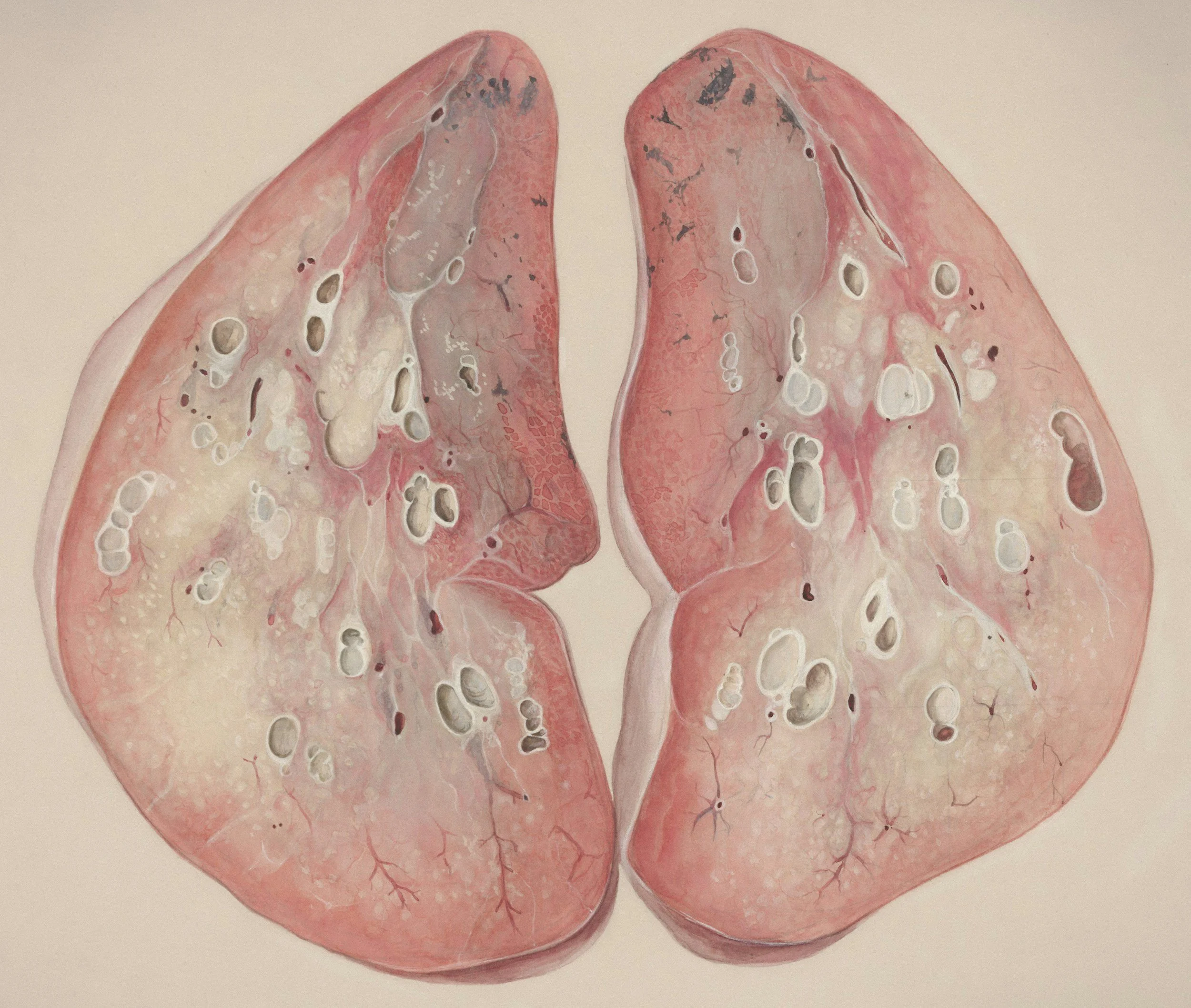 What is TPO-antibodies?