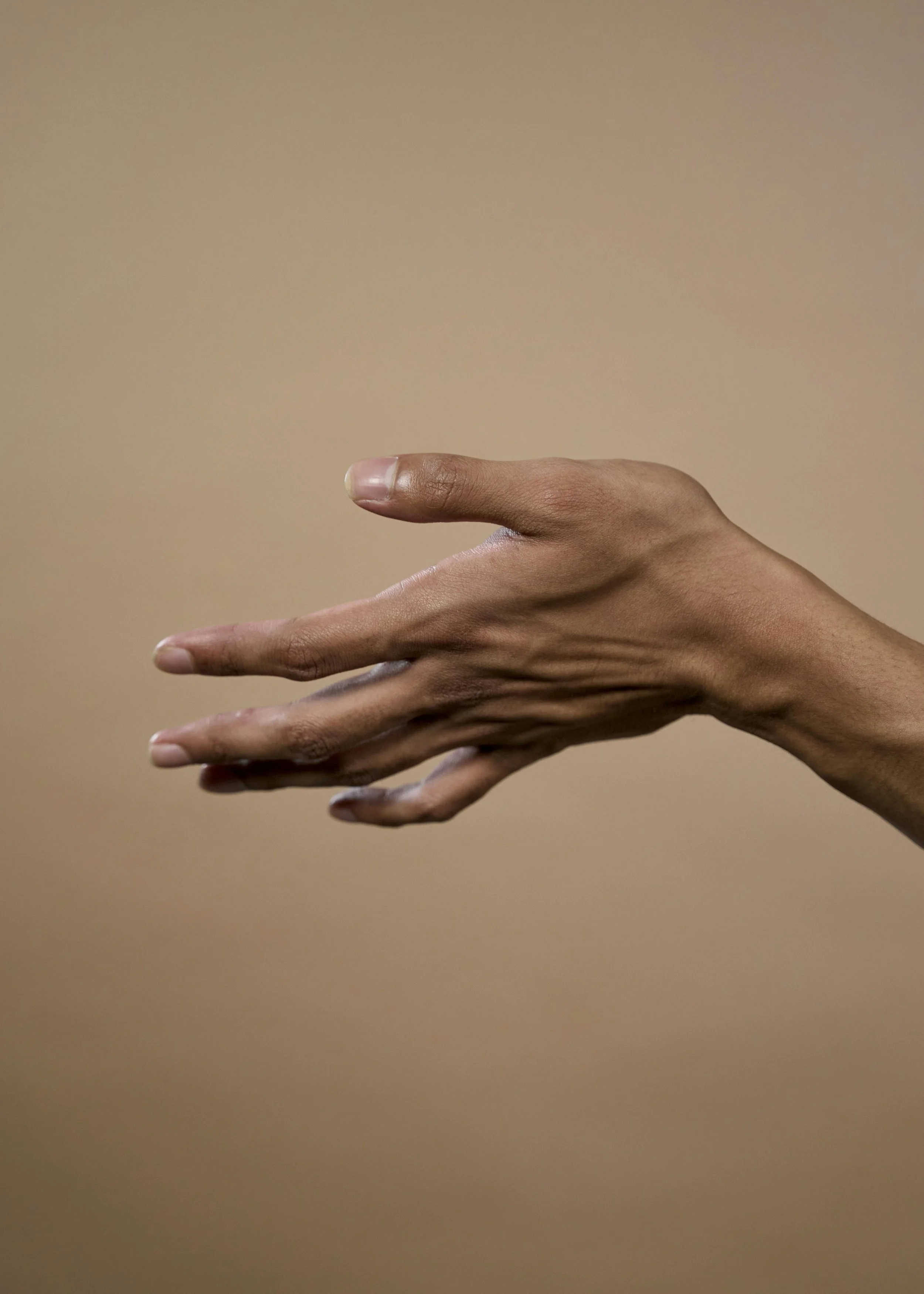 What is Rheumatoid factor?