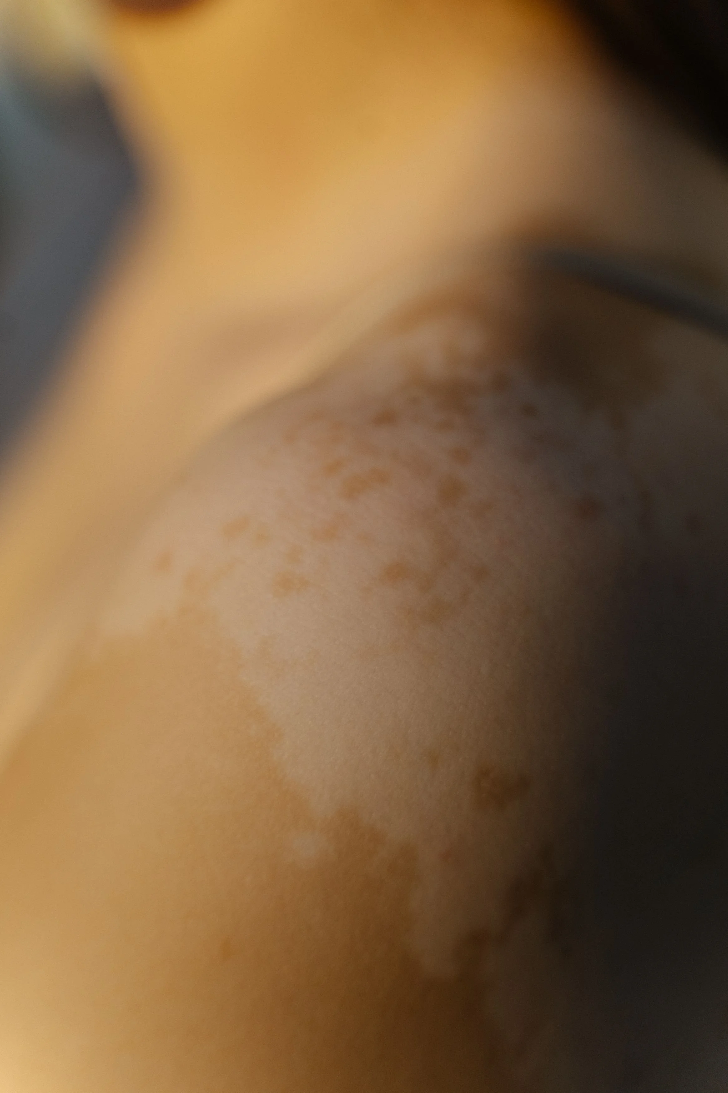 What is S-Albumin corr. Approx.?