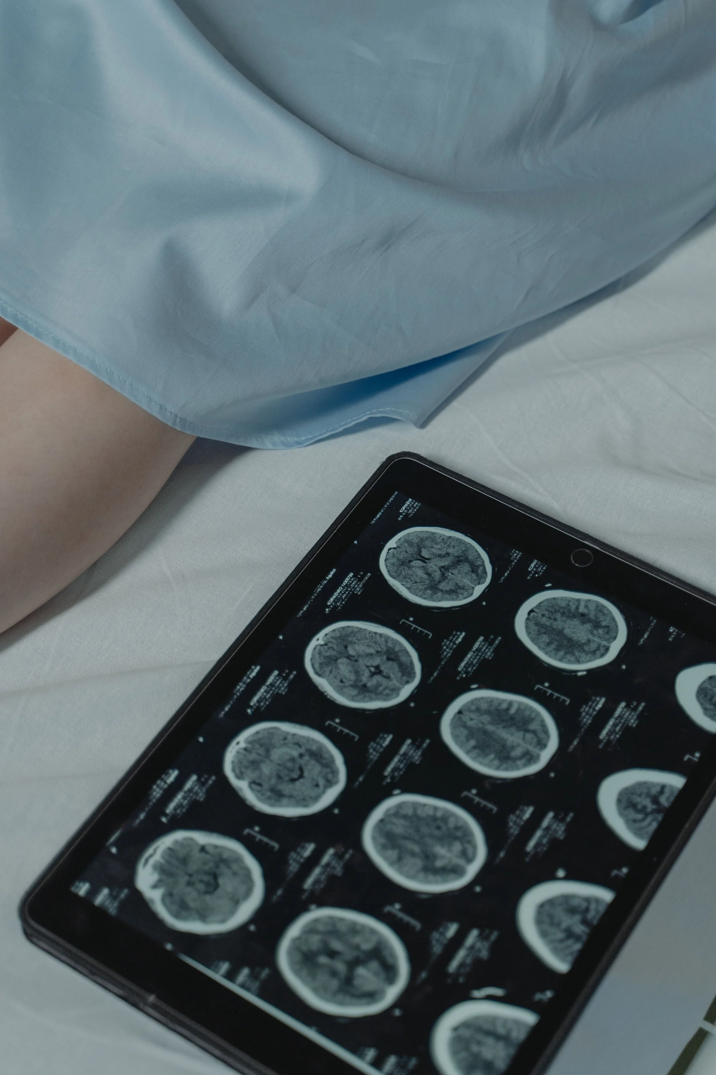 Tips for better brain health