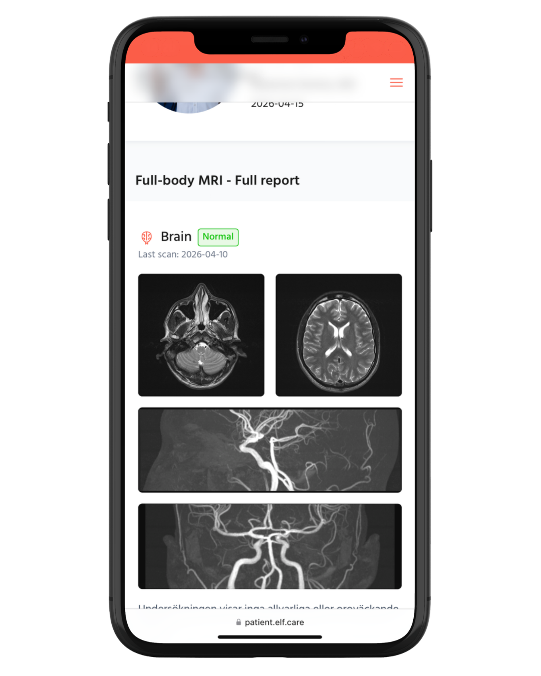 Elfcare-appen