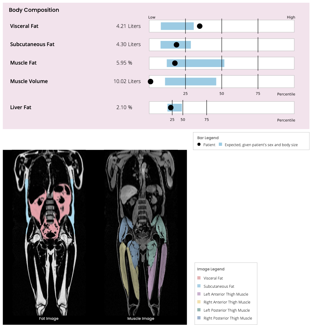 Body composition profile by Elfcare