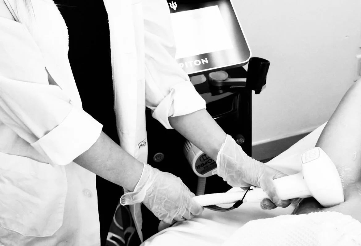 Our advanced Triton laser is one of the most powerful and effective hair removal systems out there. It uses a combination of multiple wavelengths to target hair at different depths, making treatments faster and more efficient for ALL skin tones. Say 