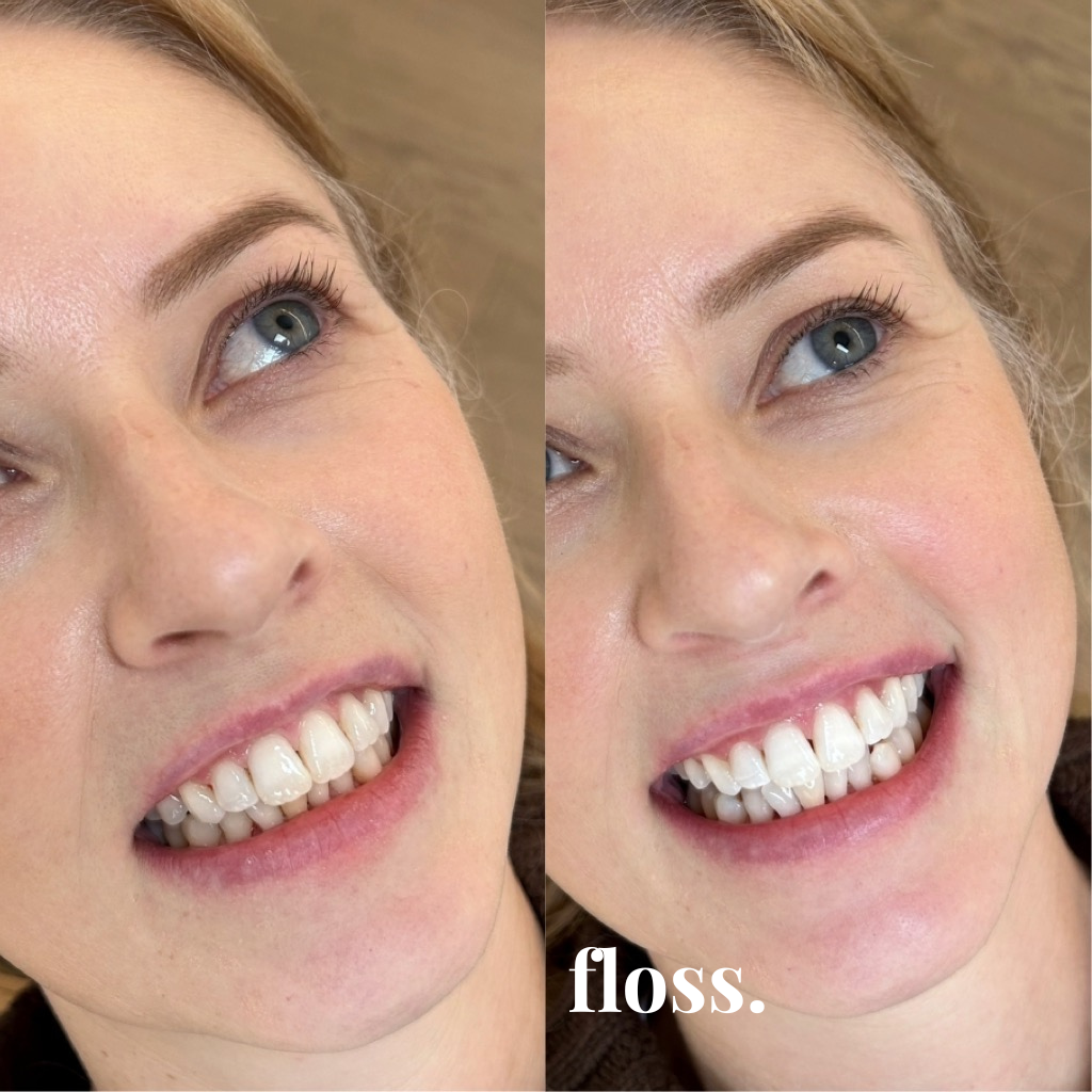 Side-by-side close-up photos of a smiling woman with blue eyes, showing her teeth before and after dental flossing. The word "floss." is written in white text at the bottom of the right photo.