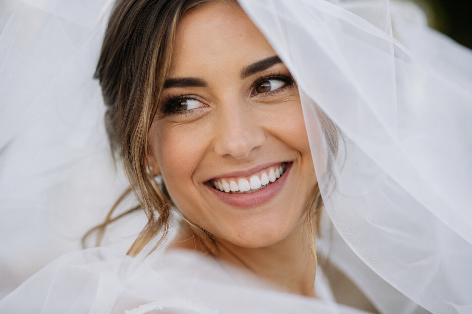 Bridal smile preparation and teeth whitening in Frankston