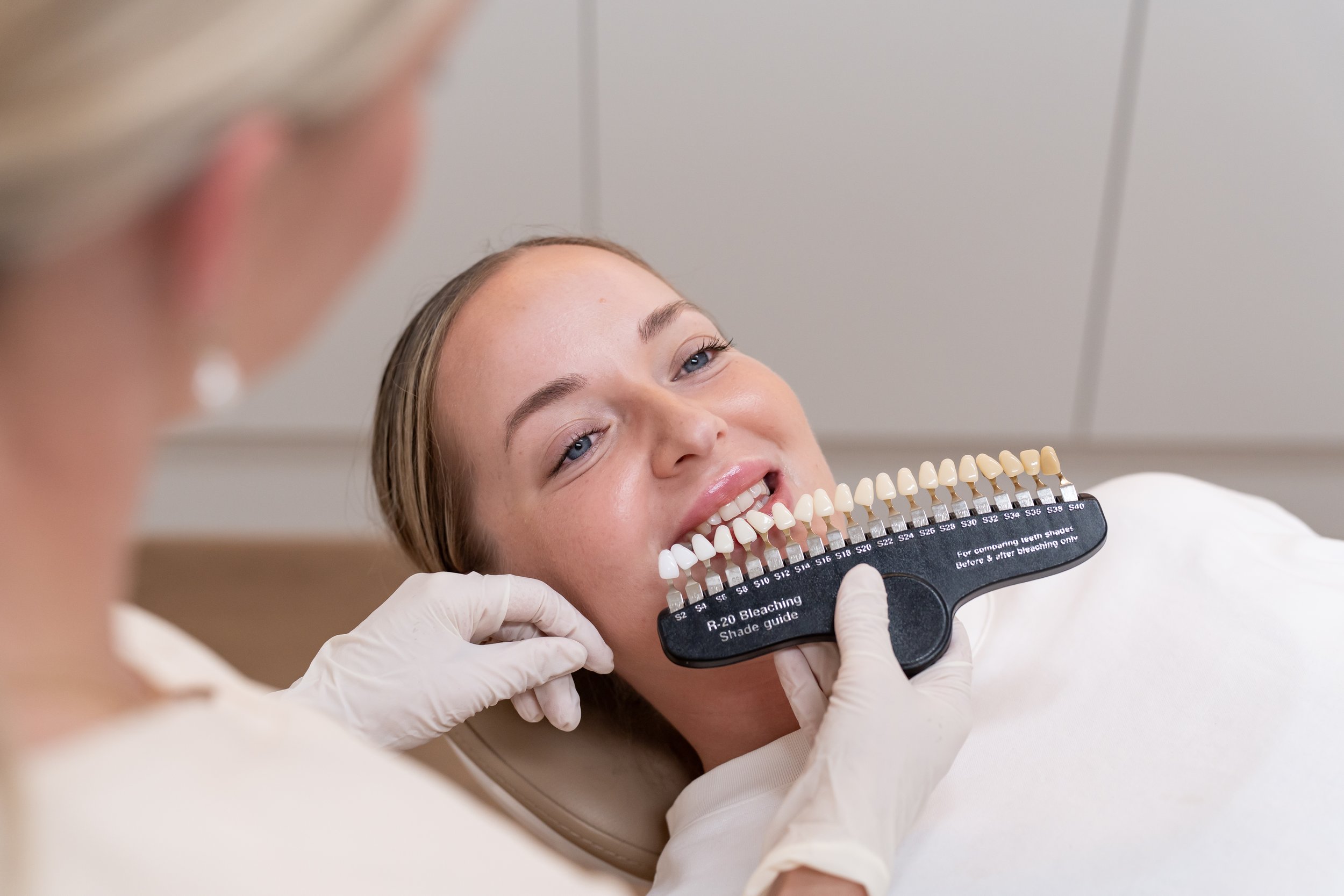 A woman with blue eyes lying on a dental chair, smiling, while a dentist holds a color shade guide to compare her teeth for whitening.