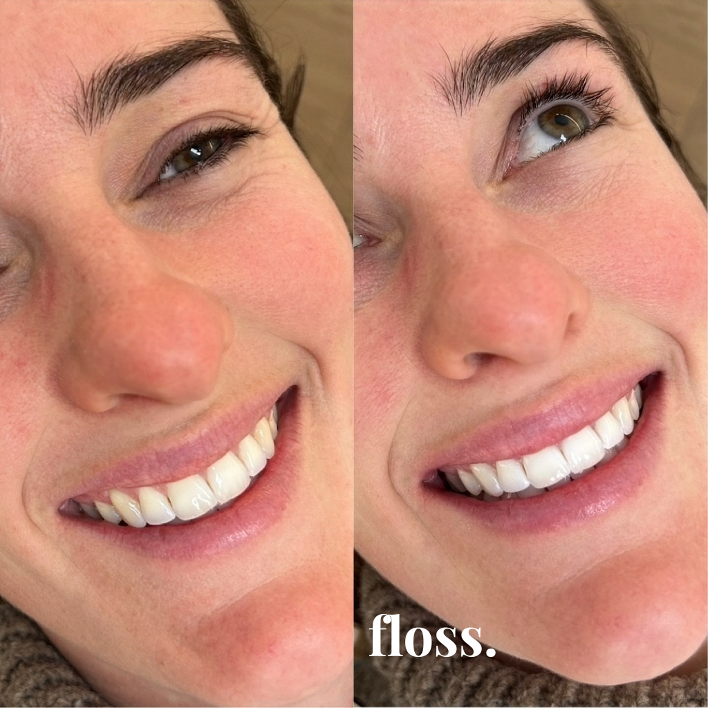 Close-up of a woman's smiling face, showcasing her white teeth. The image emphasizes her oral hygiene, with the word "floss" written on the bottom right corner.