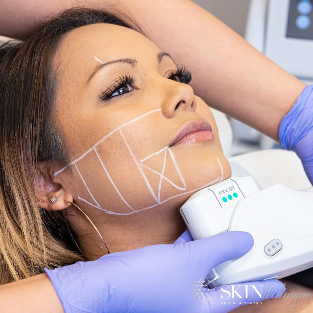 what-is-ultherapy-2.jpg