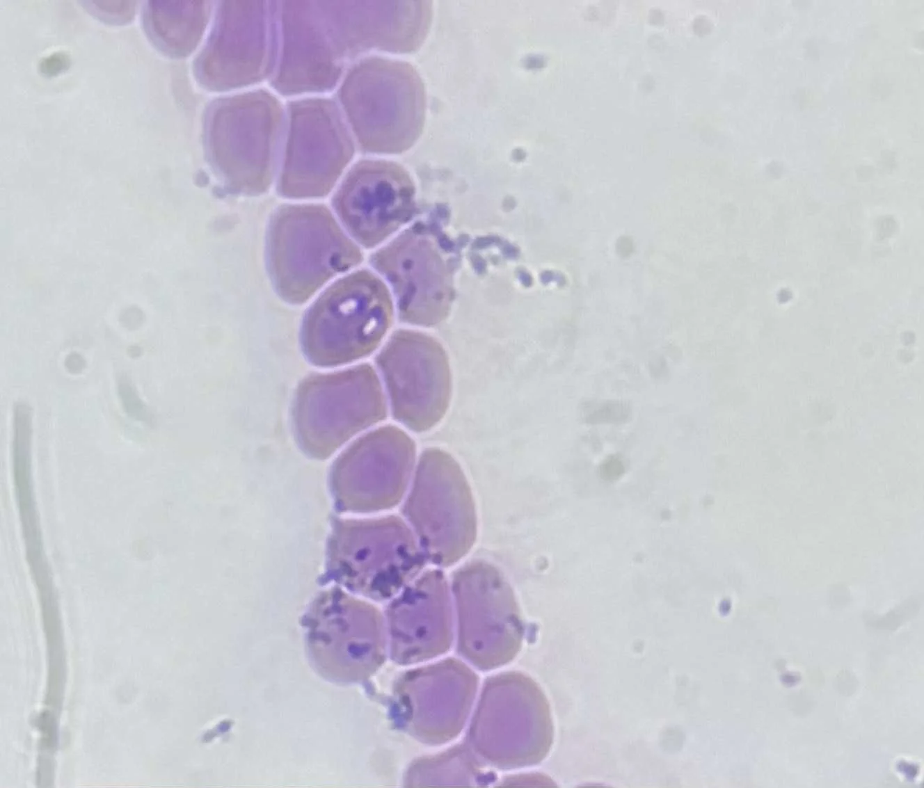 Căpușele la câini: ghid complet de prevenție și protecție împotriva bolilor