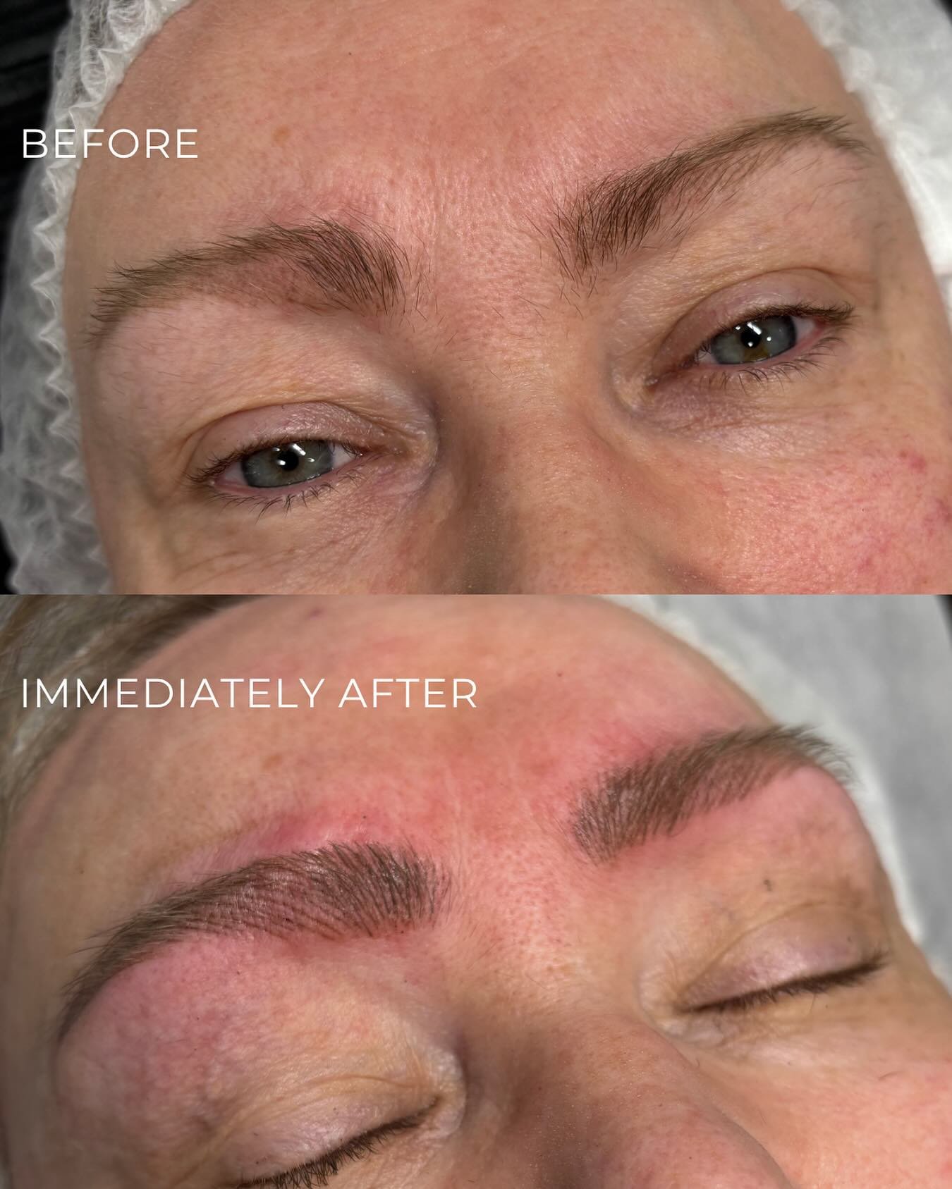Subtle changes, big difference! So happy to help this lovely client achieve more balanced, natural-looking brows. #browtransformation #ballaratsmallbusiness #supportlocalvic #cosmetictattoo #nanobrows #naturalbrowtattoo #naturalpermanentmakeup #eyebr