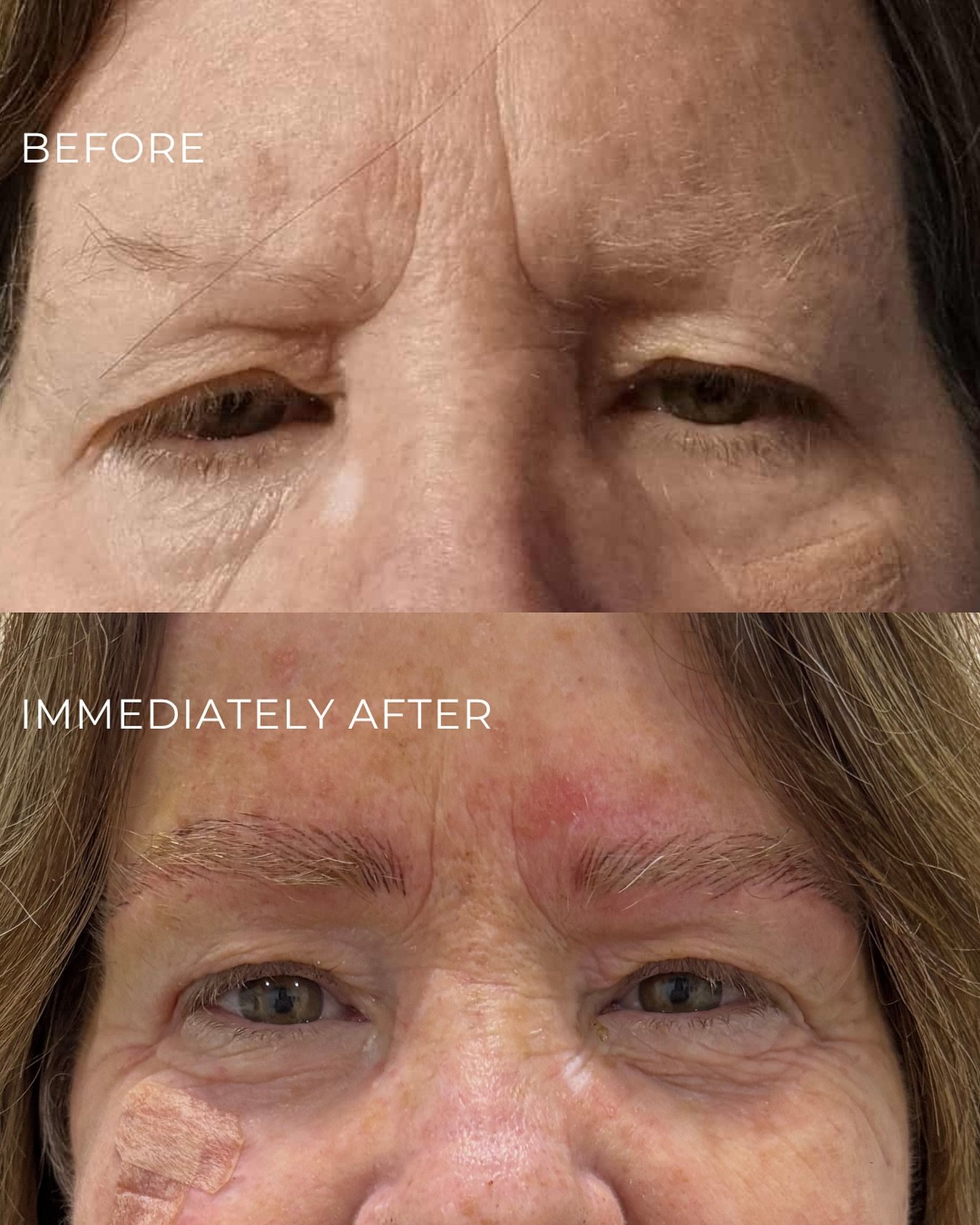 Grateful for this lovely client trusting me with her brows. I cannot wait to see how they heal.
#ballaratbrows #ballaratsmallbusiness #subtlepermanentmakeup #pmu #nanobrowsmelbourne #nanobrowsballarat #permanentmakeupmelbourne #supportlocalvic #cosme