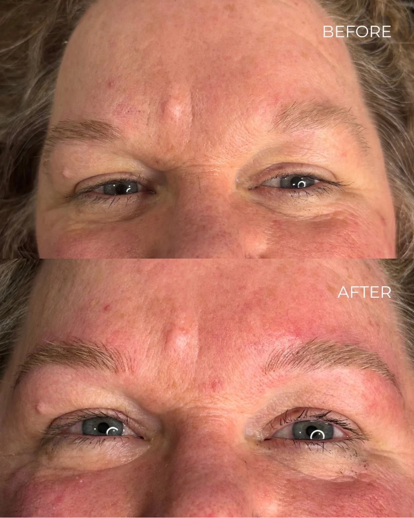 Subtle changes can make the world of difference. 
I loved my client&rsquo;s reaction to seeing her brows in the mirror - &ldquo;oh my god! It looks like I haven&rsquo;t even had anything done! In the best way&rdquo; #naturalpermanentmakeup  #nanobrow