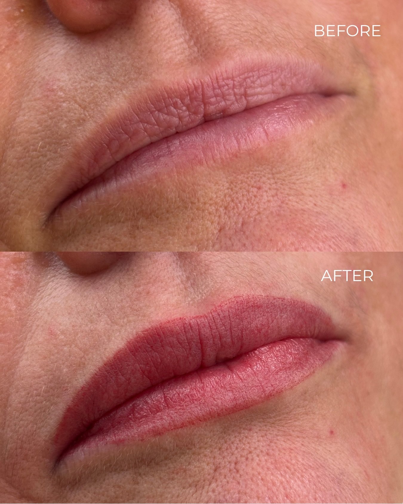 Want a subtle, natural flush of colour? Sheer lip blush is the perfect solution. I space the pixels out evenly to create the illusion of a solid wash of colour. Even this &ldquo;after&rdquo; will heal 30-40% softer! You still get the definition of a 