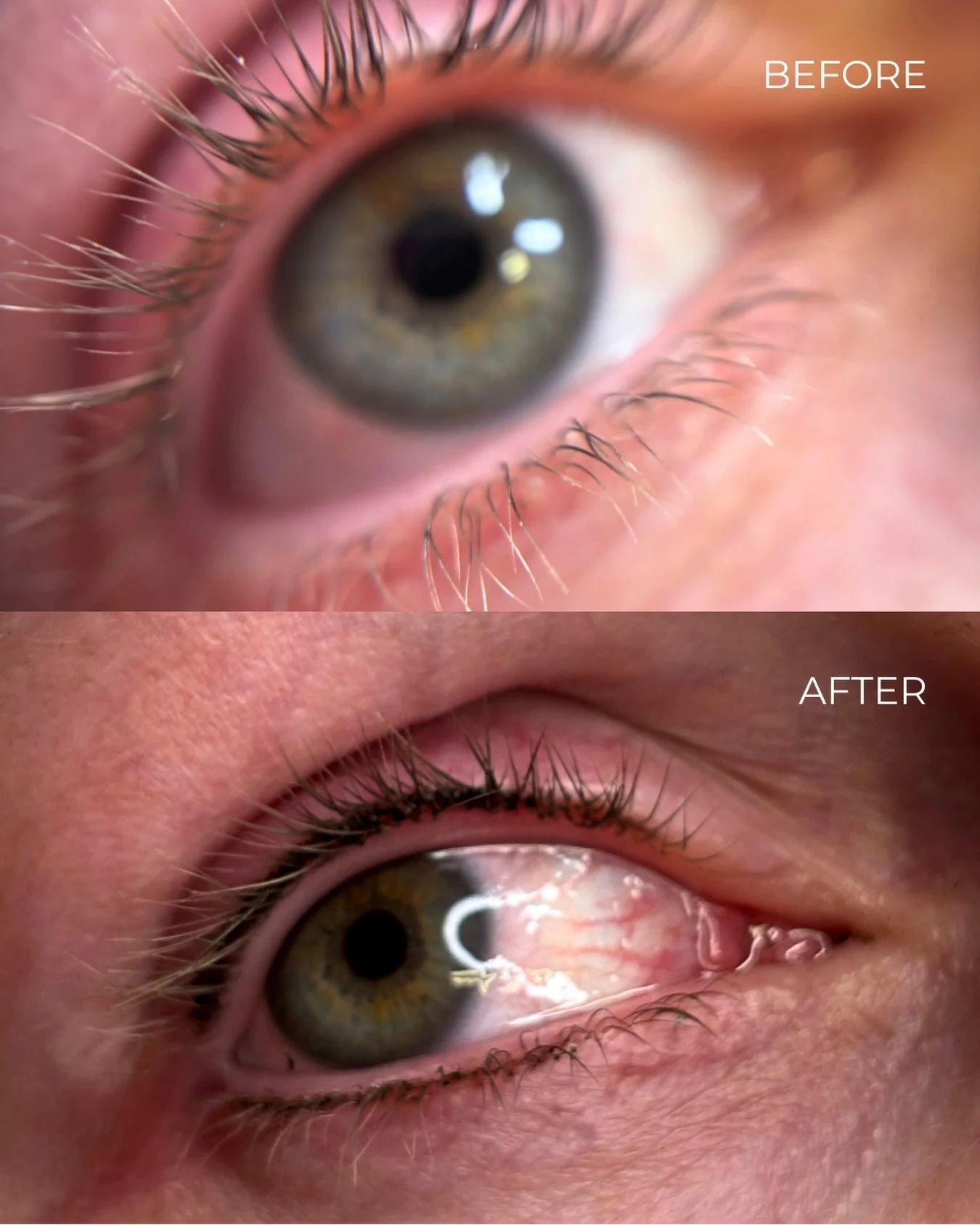 Lash Line Enhancement!

This is a semi permanent enhancement that carefully and precisely fills in your lash line with ink, giving you a much fuller looking lash.
Perfect for those who have thought about eyeliner tattoo but don&rsquo;t want to commit