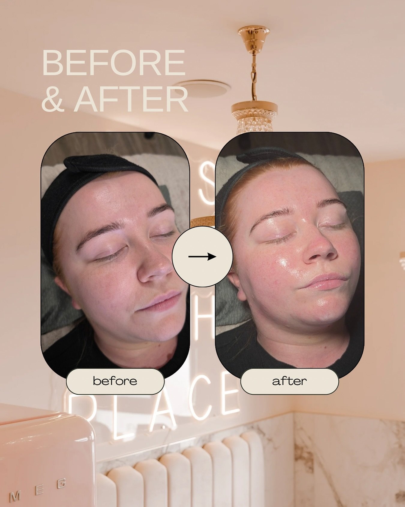 Treat your skin ✨