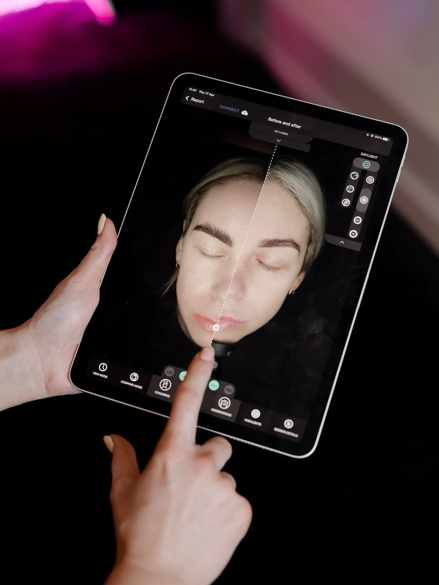 Ever wondered what your skin really needs? 👀🧬⁣⁣

Our OBSERV 520x lets us see what&rsquo;s happening beneath the surface. Sun damage, pigmentation, dehydration, oiliness, and more. Even before it becomes visible.⁣

⁣⁣This means your skin plan isn&rs
