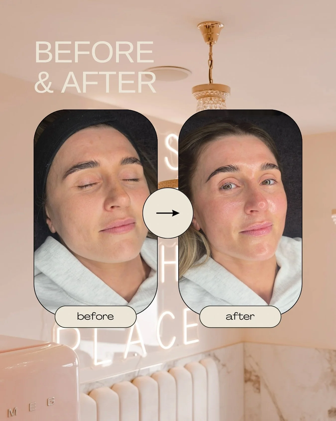 Let&rsquo;s Glow ✨

Check out all of our facials online now 💕