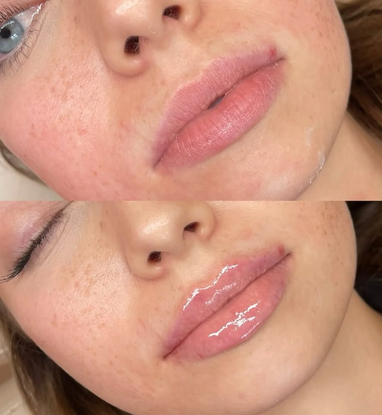 Undetectable is how it should be 👀 💉