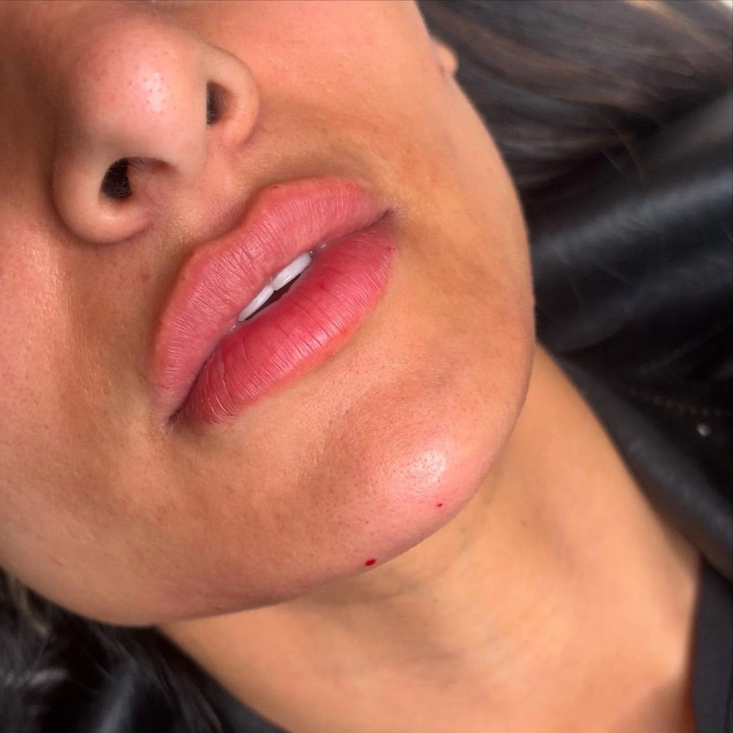 Soft definition, seamless balance 💫 Lip &amp; chin refresh.