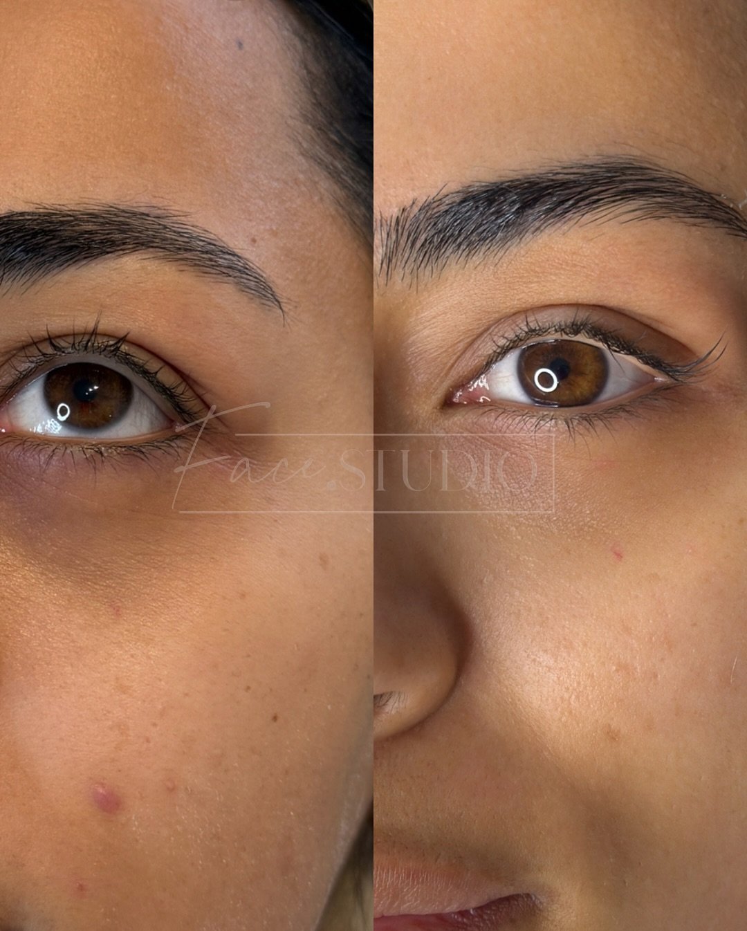Imagine waking up to refreshed under eyes, eyes looking brighter rather than dull, eyes looking like they&rsquo;ve had 10 hours sleep rather than 4 hours, redness - disappeared &amp; overall feeling more yourself and confident!🤎

The power of polynu