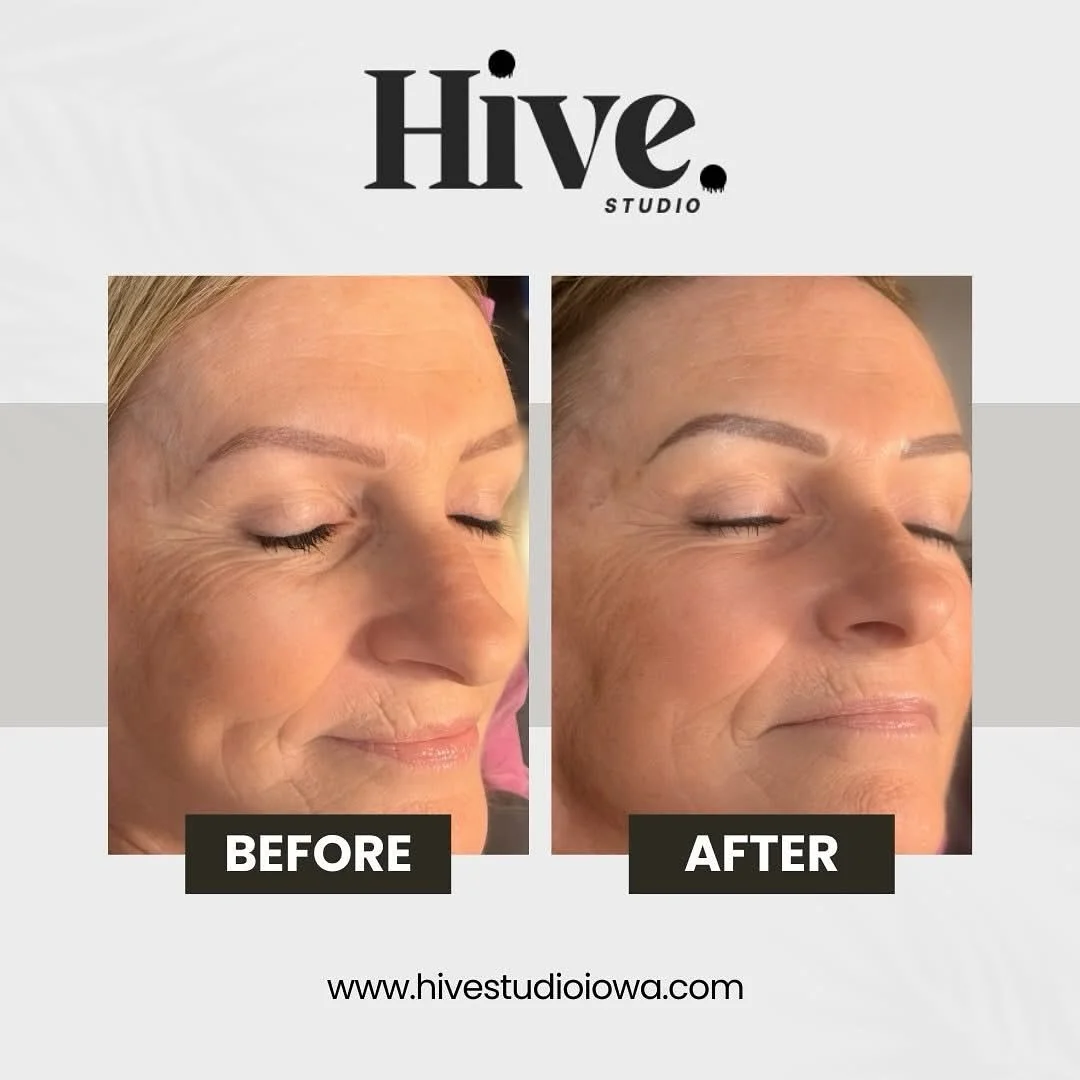 β¨ How flawless do these Powder Brows look?! π
This beauty came in for her touch-up session and left absolutely glowing! π«
If you’ve been dreaming of low-maintenance, smudge-proof brows — this is your sign π
β¨ Why you’ll love P