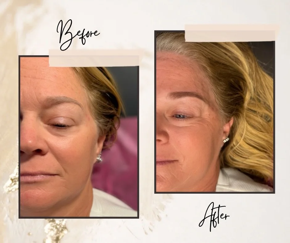 ✨ 6-Week Touch-Up Glow! ✨

Her Powder Brows healed beautifully, and this touch-up locked in that soft, shaded perfection.
If you&rsquo;re tired of filling in your brows every morning, Powder Brows give you:

✔️ Wake-up-and-go brows
✔️ Soft, natural d