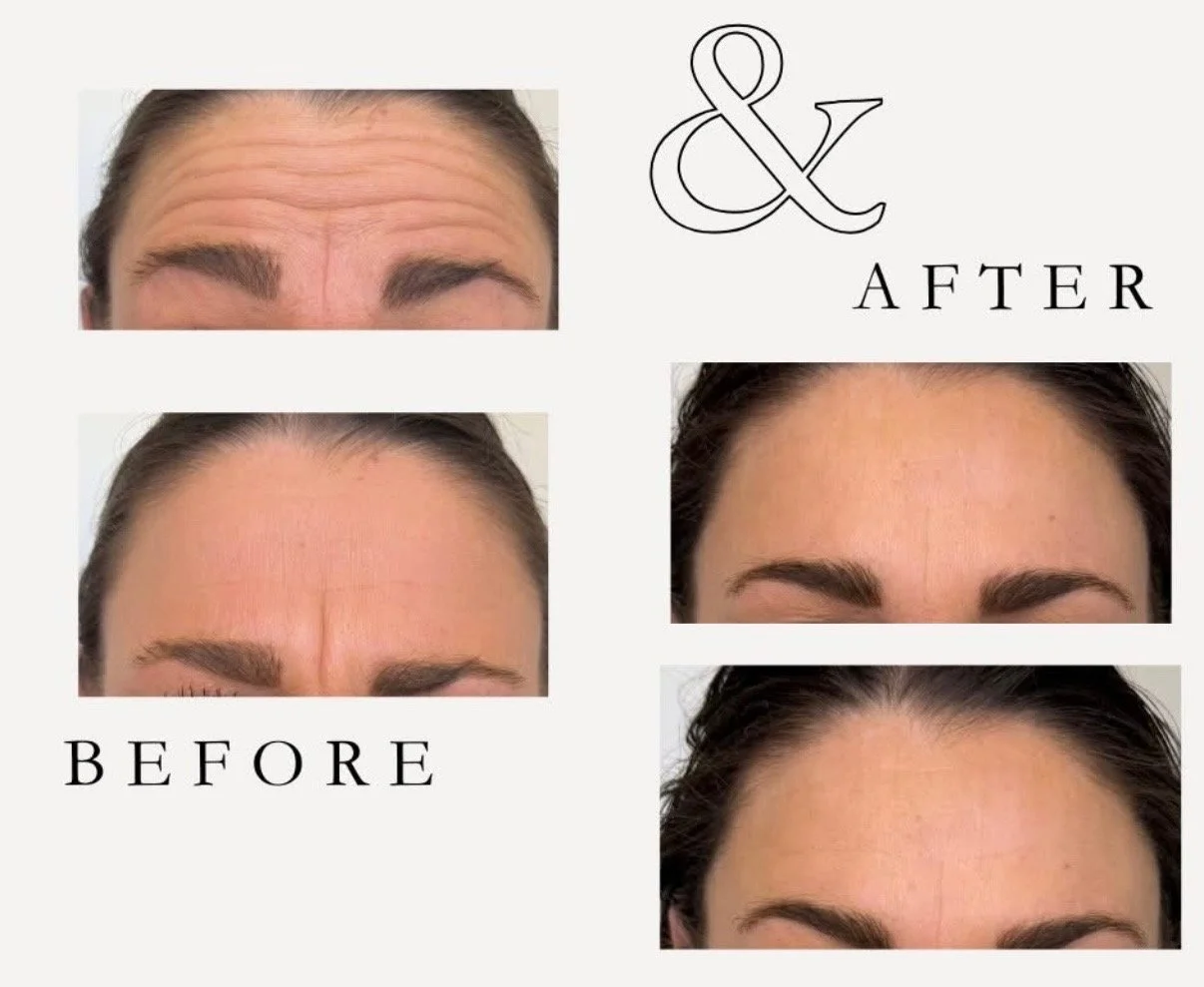 Before_after.jpg