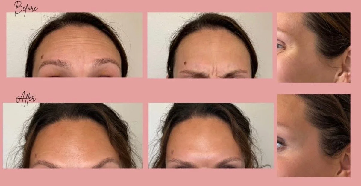 beforeandafter.jpg