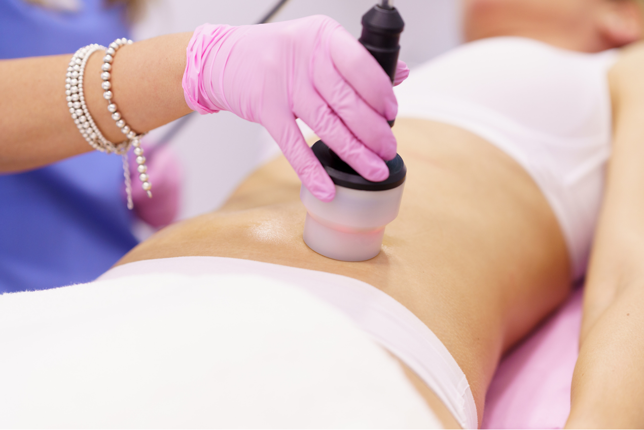 Revive Wellness and Esthetics Body Contouring Hero