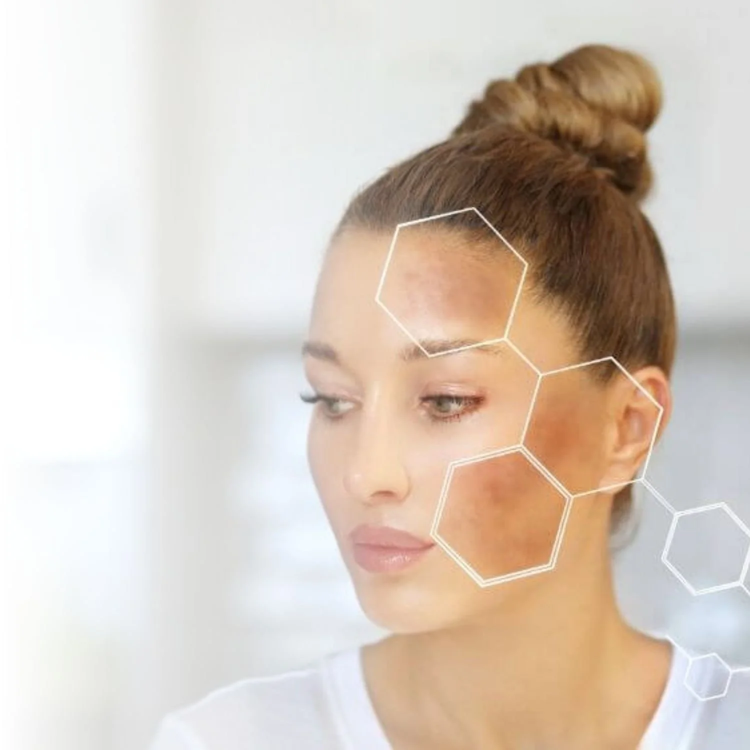 Woman with digital hexagons highlighting skin spots on face.