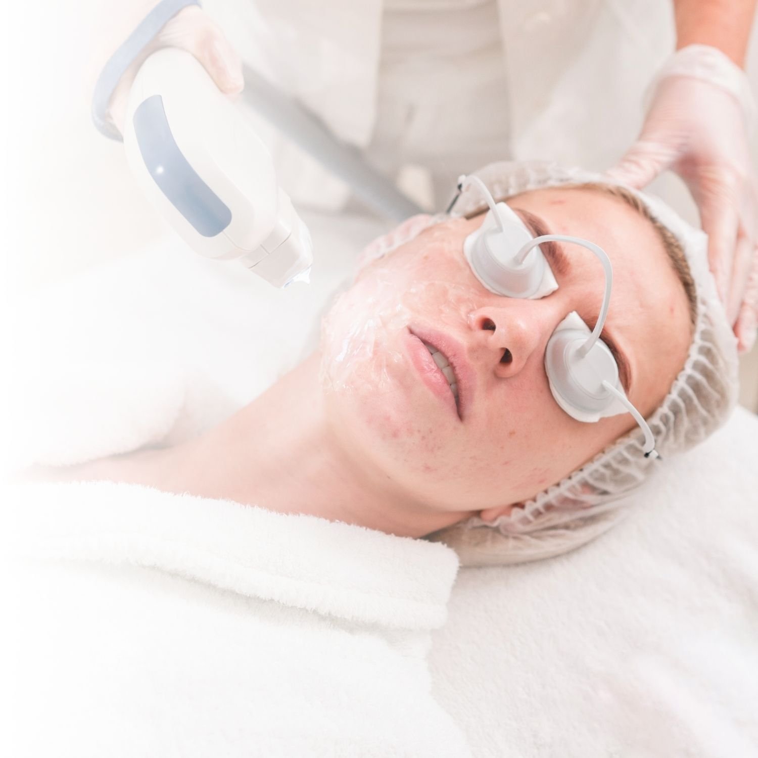 Person receiving a laser facial treatment with protective eyewear, wearing a white robe and hair cap.