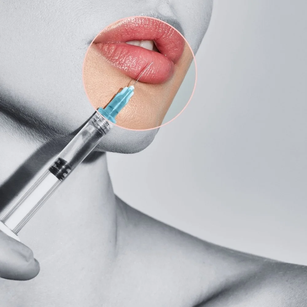 Dermal Fillers: - Restore lost volume, enhance definition, and rejuvenate your features with expertly placed dermal fillers. From cheeks and lips to jawline and under-eyes, we create beautifully balanced results with a light touch and clinical precis