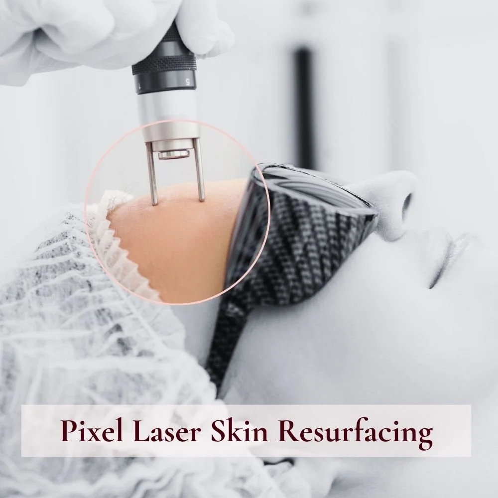 Pixel Laser Skin Resurfacing: - Refine texture, reduce scarring, and rejuvenate dull skin with fractional Pixel laser resurfacing. This powerful skin renewal treatment stimulates collagen, revealing brighter, smoother, and firmer skin with minimal do