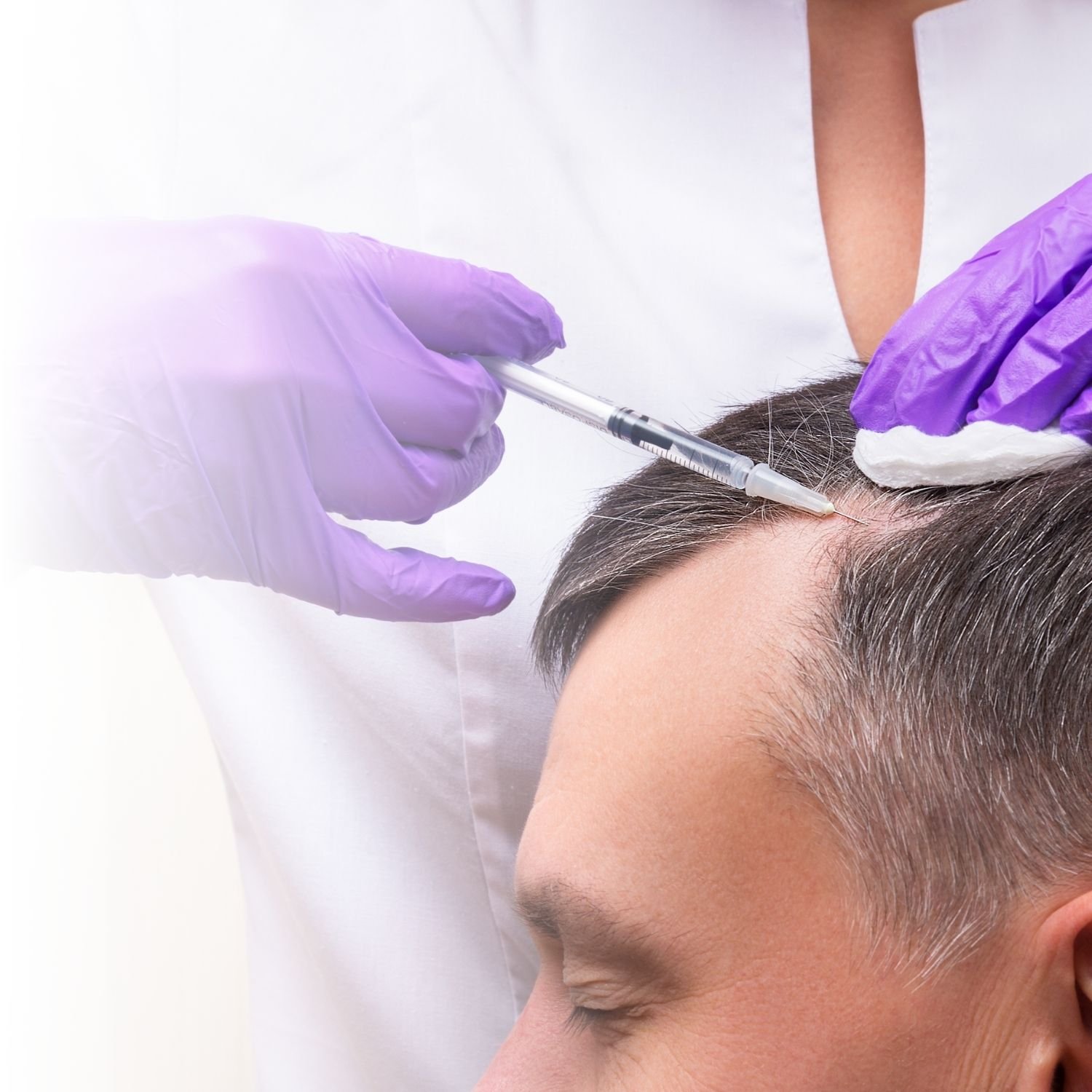 Medical procedure with purple-gloved hands injecting a syringe into a man's scalp.