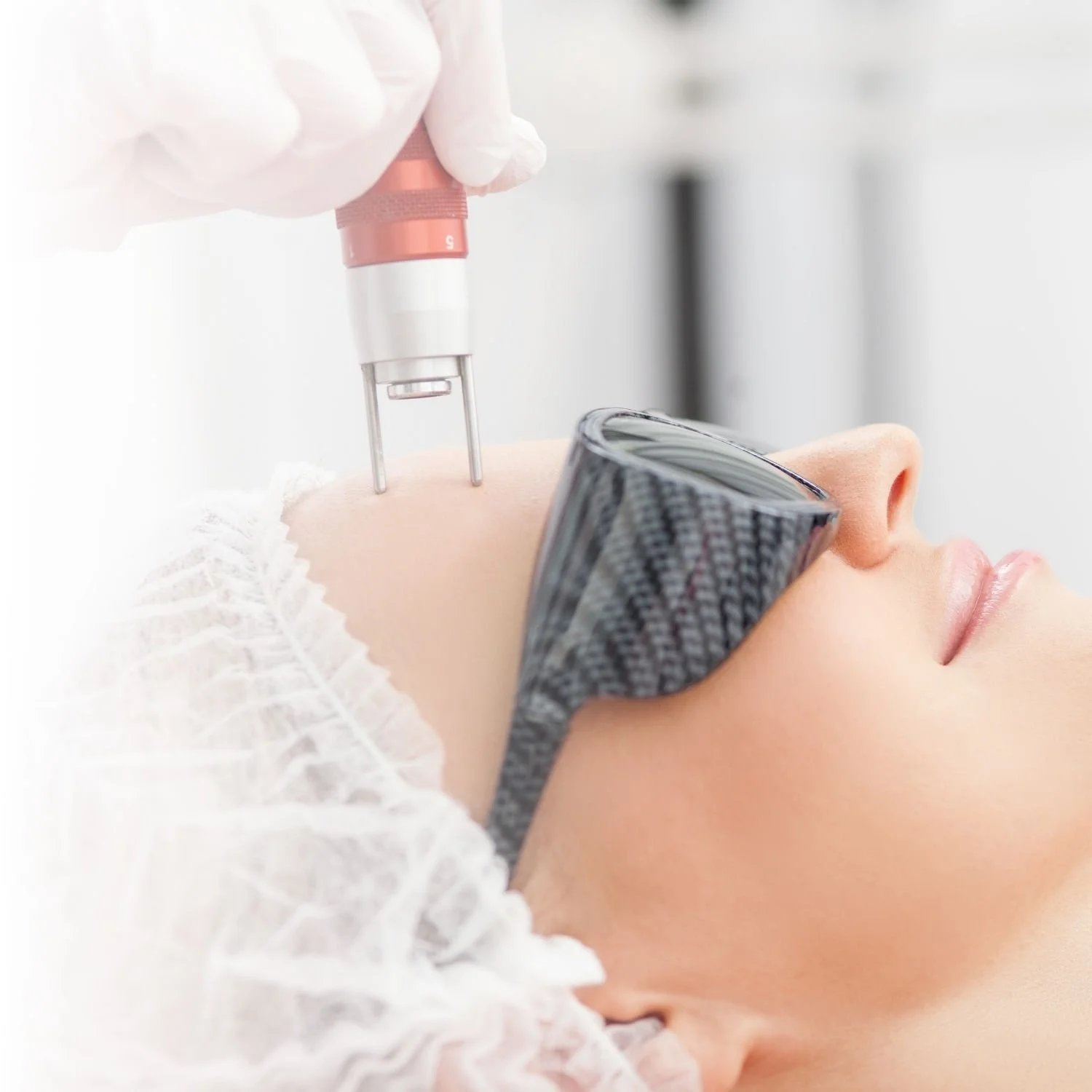 Person receiving laser skin treatment while wearing protective eyewear