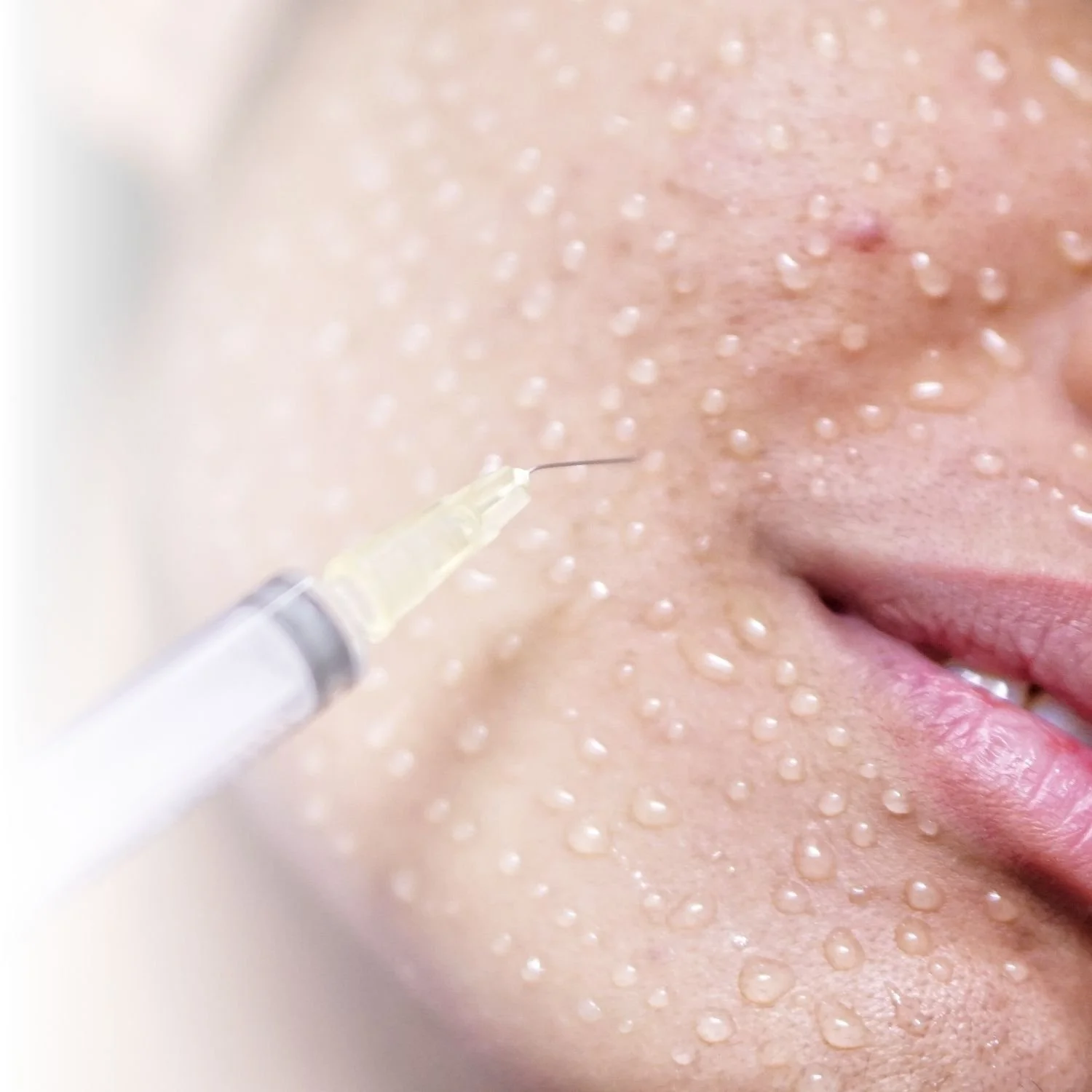 Close-up of a syringe near a person's cheek with droplets, possibly for a skincare or cosmetic procedure.