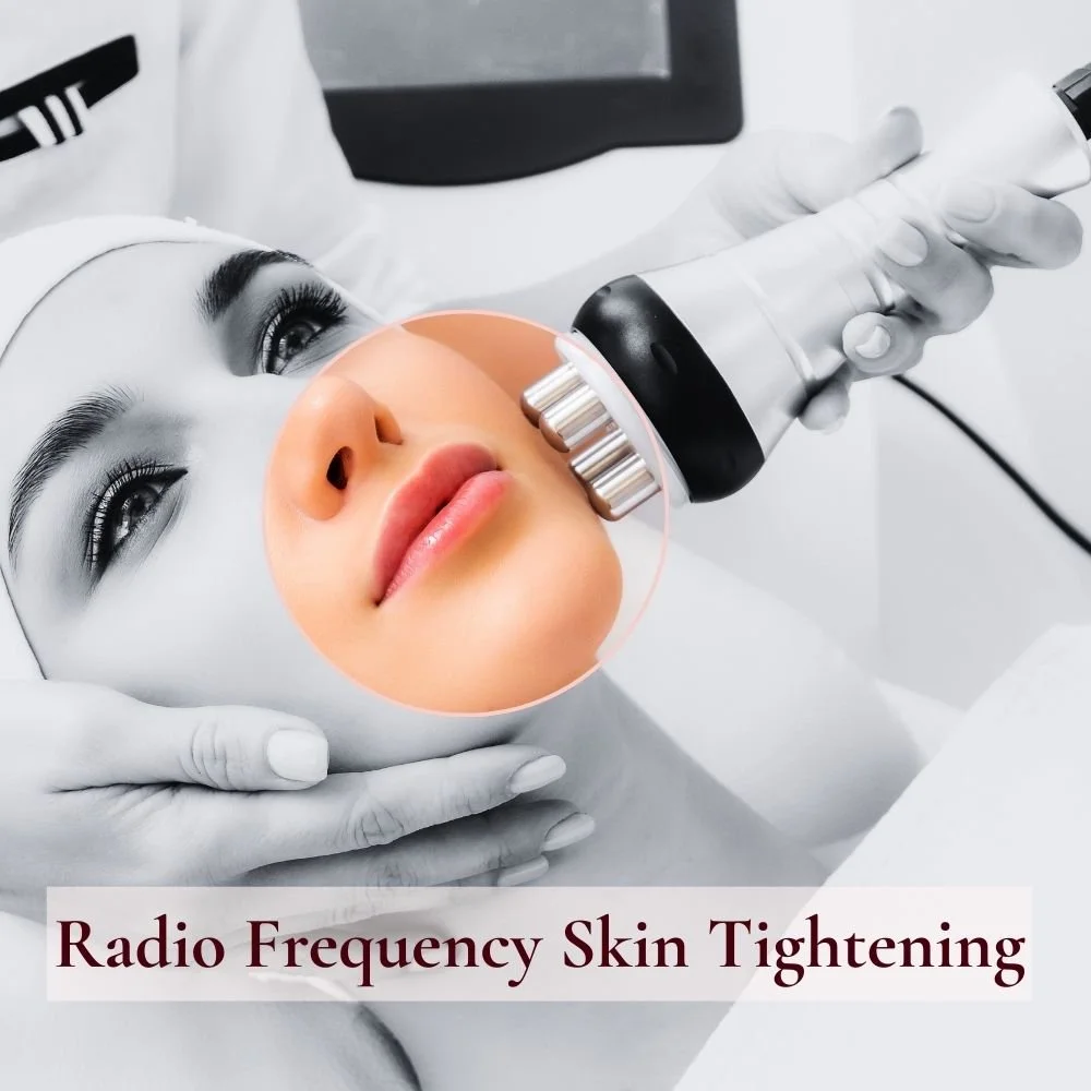 Radio Frequency Skin Tightening: - Lift, firm and tighten loose or ageing skin with gentle radio frequency technology. Ideal for jawlines, necks, arms and more, this non-surgical treatment stimulates deep collagen for visible, natural results.