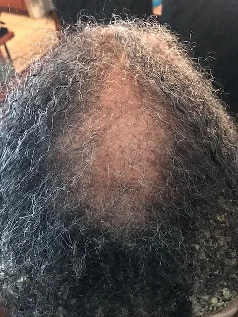 Top of a person's head with curly hair and a visible bald spot.