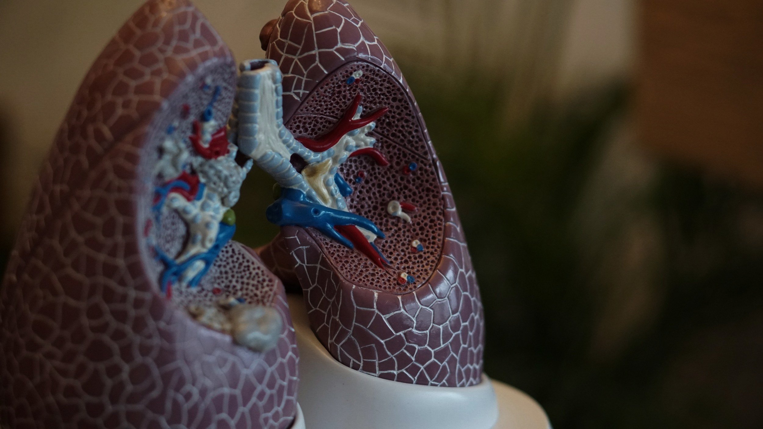 A Breath of Hope: Redefining Lung Cancer Outcomes with Modern Medicine