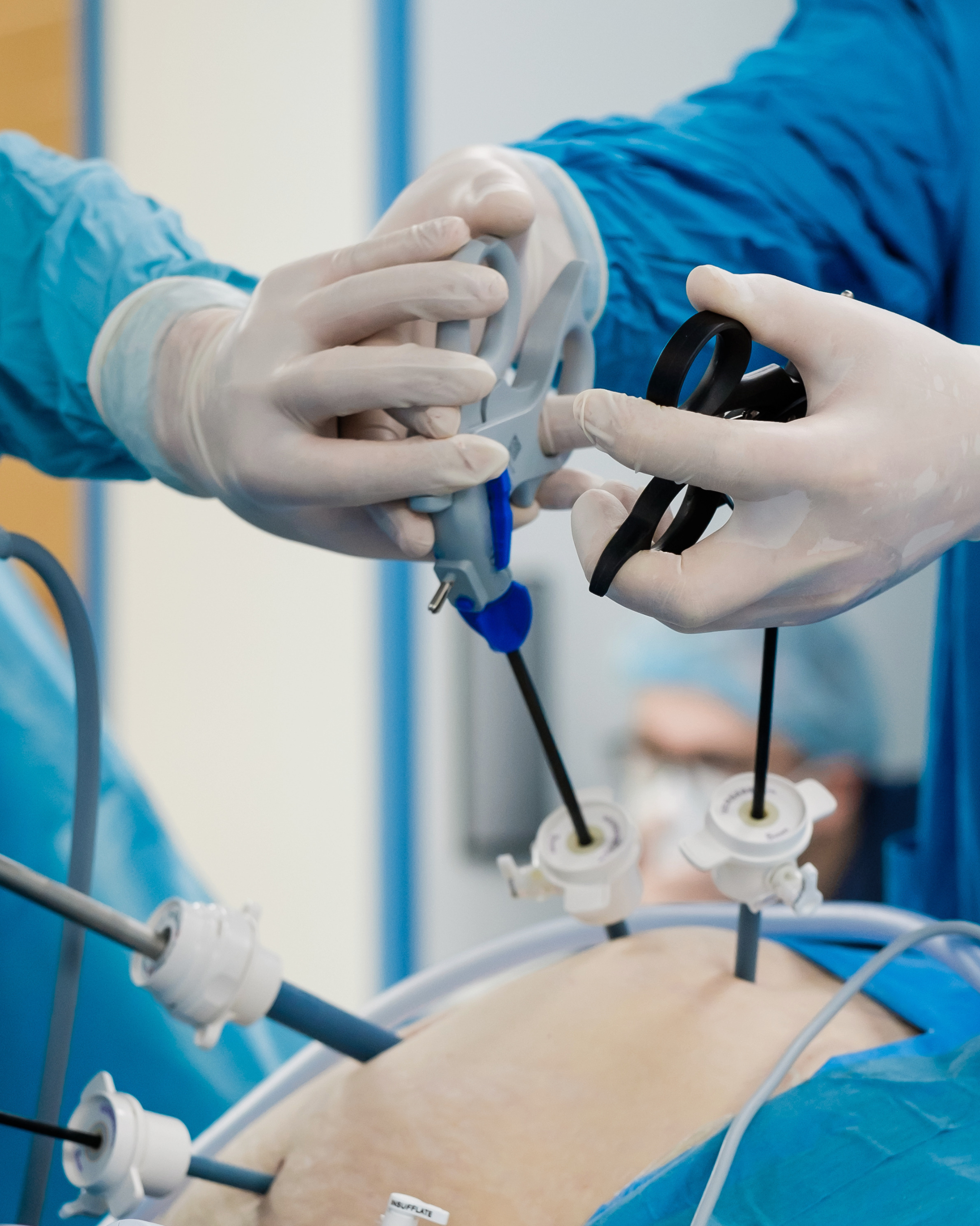 Am I a Candidate for Gastric Sleeve Surgery?