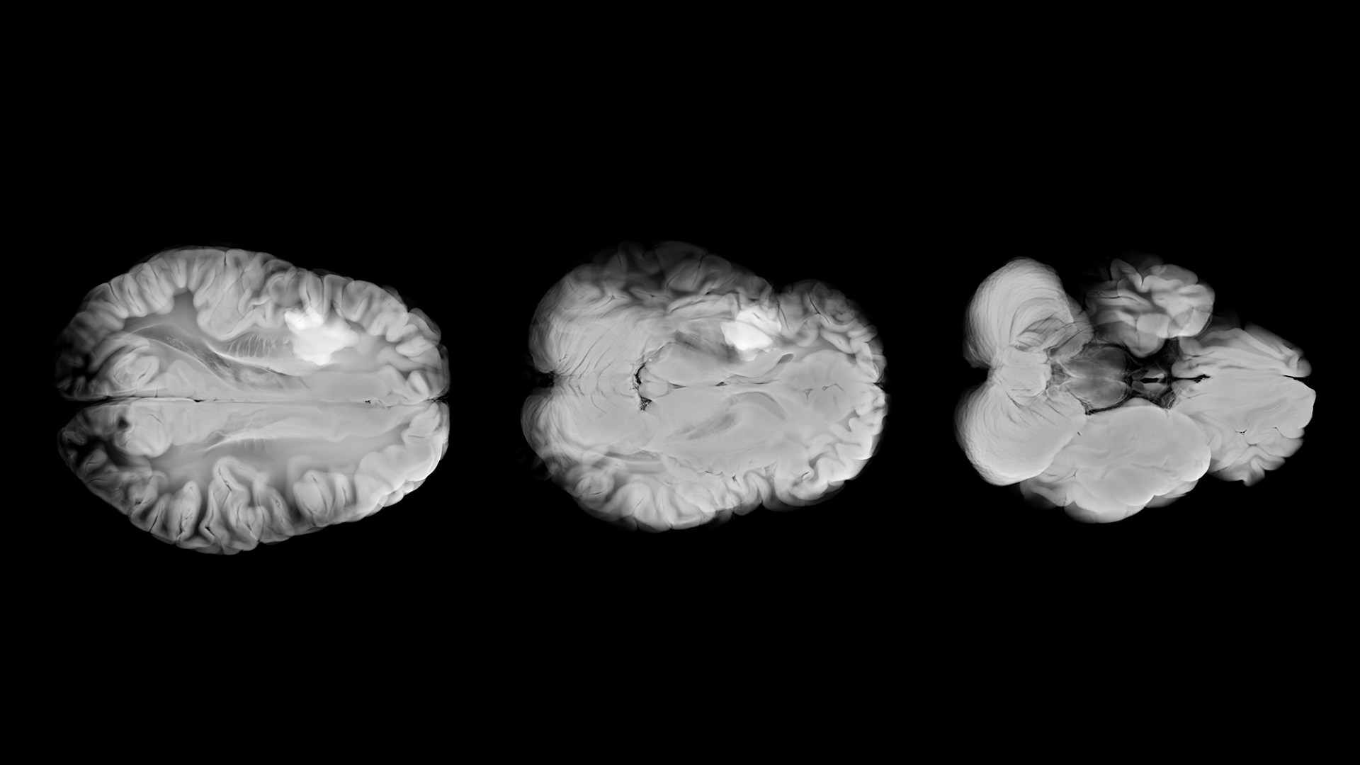 What happens when thinking becomes optional?