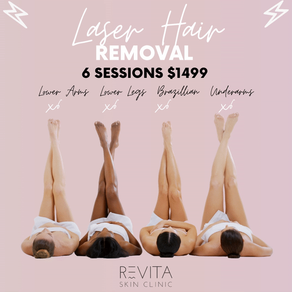 Laser Hair Removal Social Media Tile for Revita Skin Clinic by Tassja Cadoch.GIF
