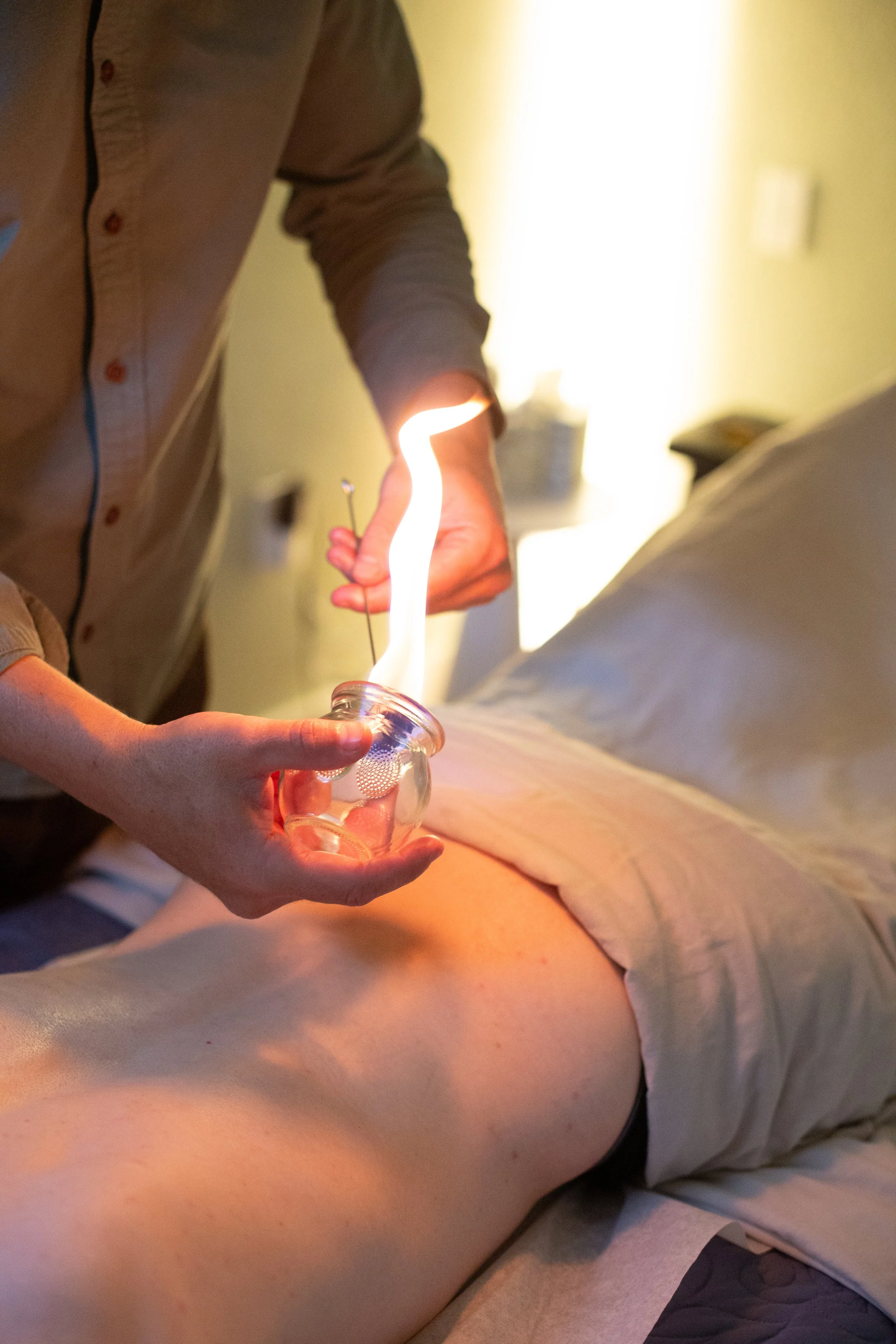 Seth performing fire cupping.