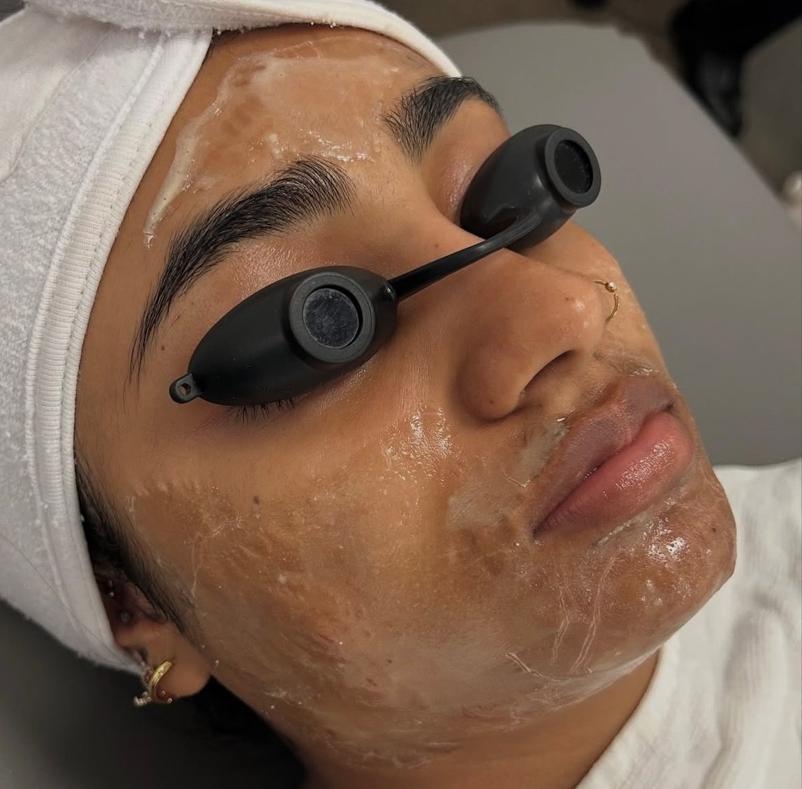 Face Foundries Firm AF using @circadia firming peptide mask, this mask has advanced peptide and antioxidant technologies to promote microcirculation & detoxification + provide instant lifting and toningβ¨π«§#minneapolis #minnesota #esthetician #est