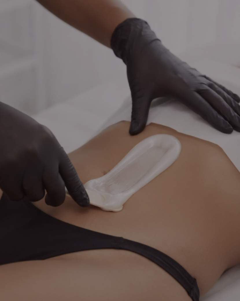 A person applying wax to a person's lower back for hair removal, wearing black gloves.