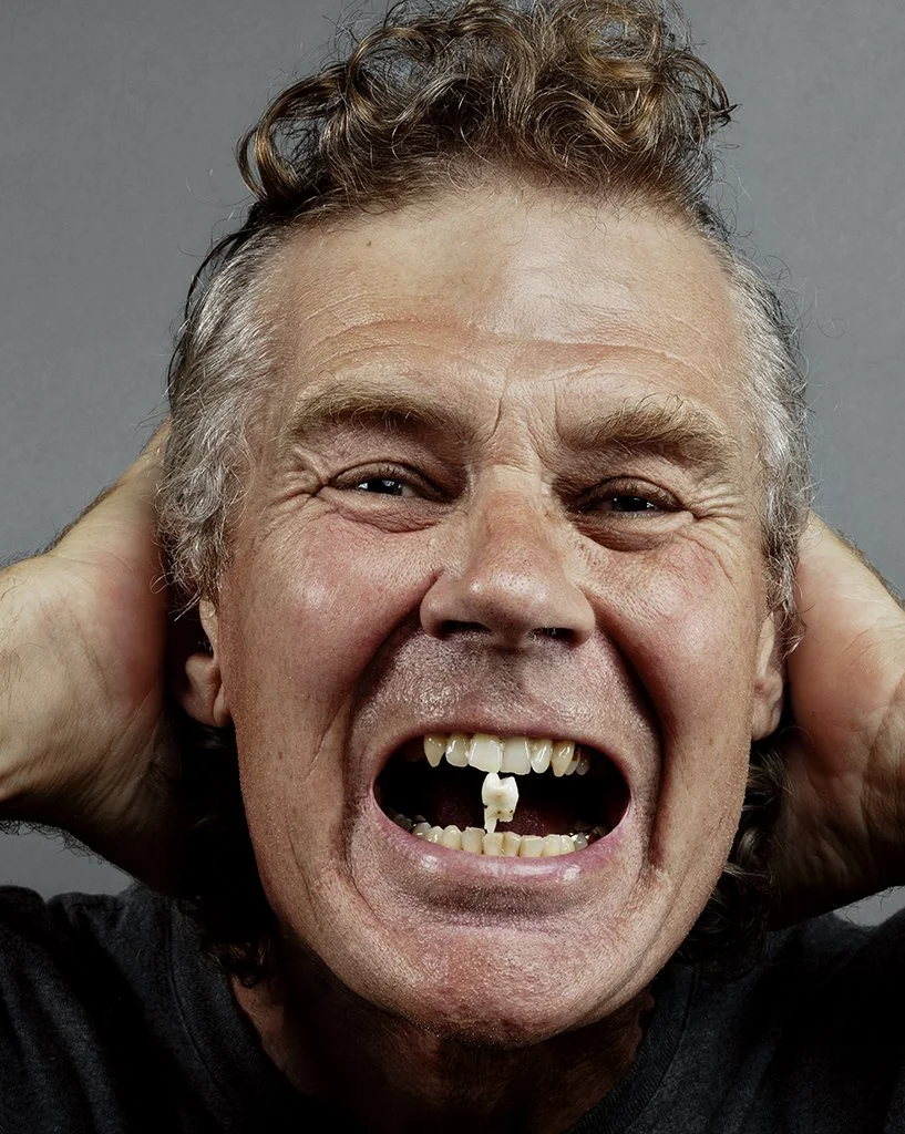 #12 - Tooth C-14 - [10.5"x8.5"]