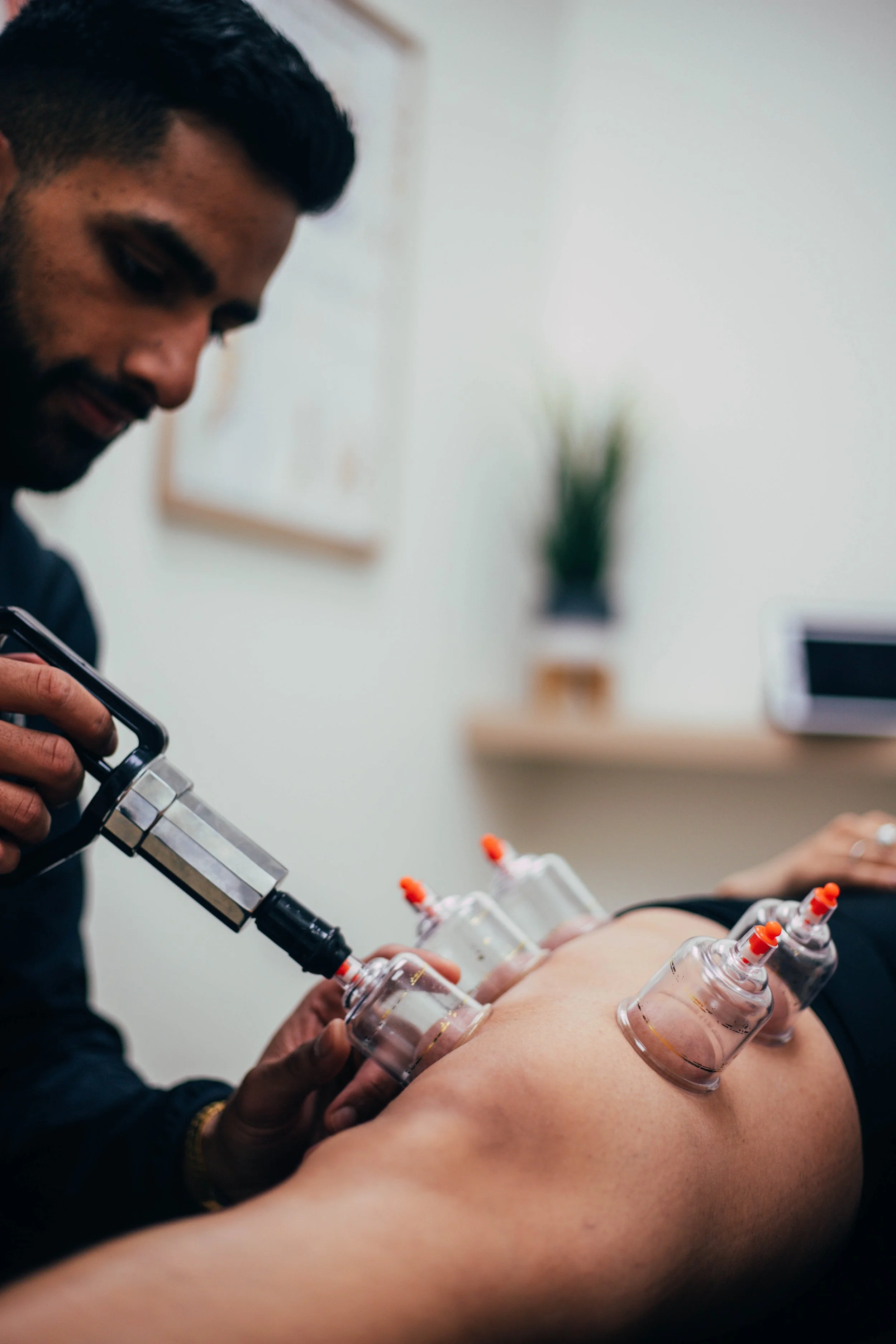 Brampton Physiotherapist Cupping a Patient's Leg