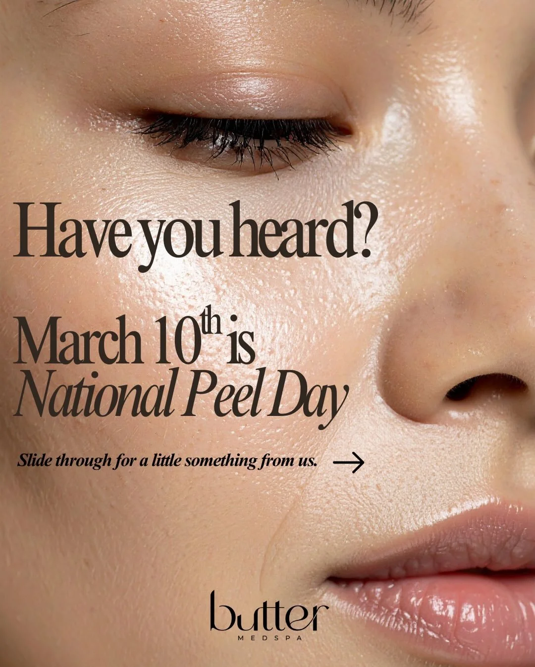 Happy almost National Peel Day 💛

We offer customized peels for acne, pigment, anti-aging, and glow &mdash; and today we&rsquo;re celebrating with a special new client promo at the end of this carousel.

Think smoother texture.
Clearer pores.
More e